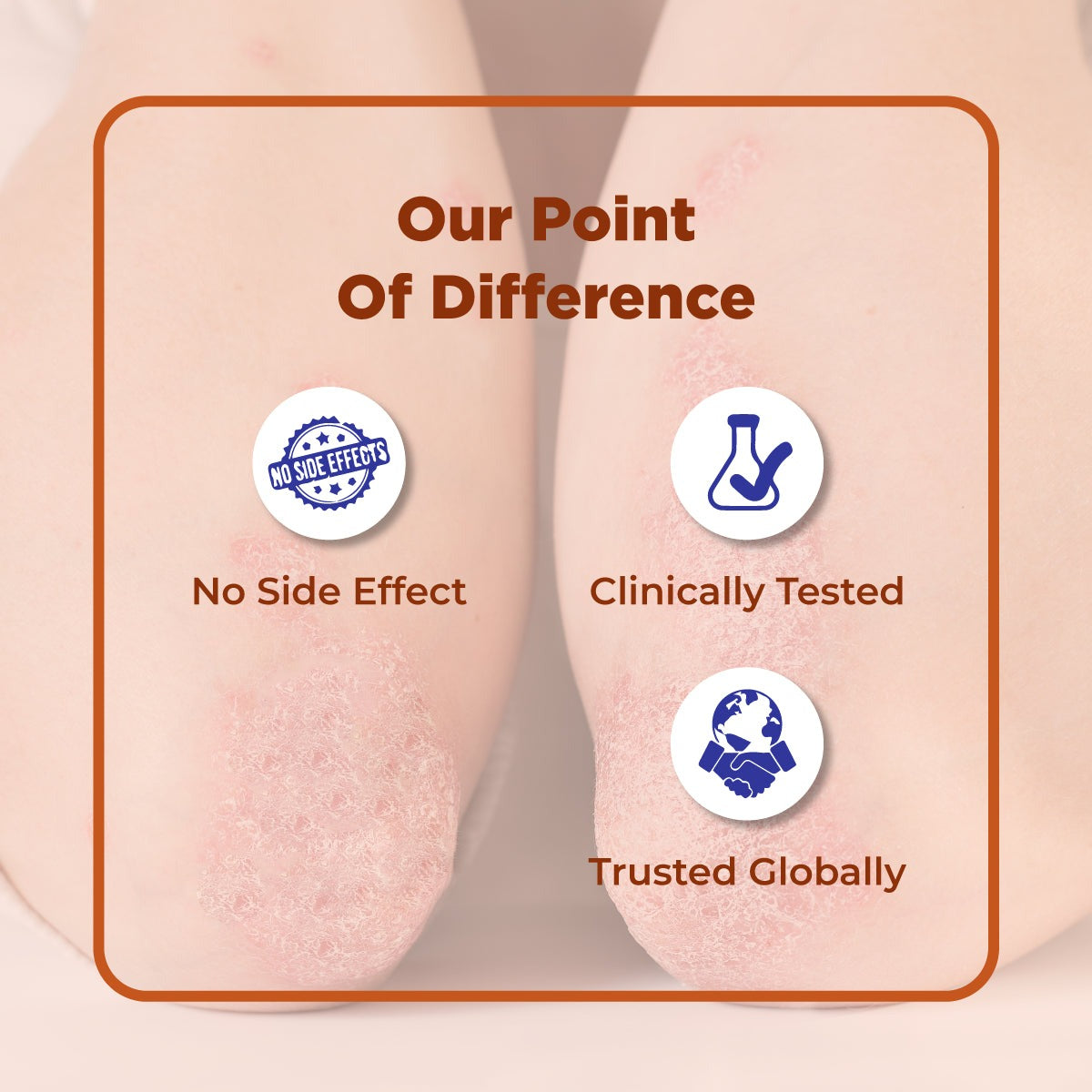 AyuDerme: A Natural Solution for Skin Disorders - Welex Care