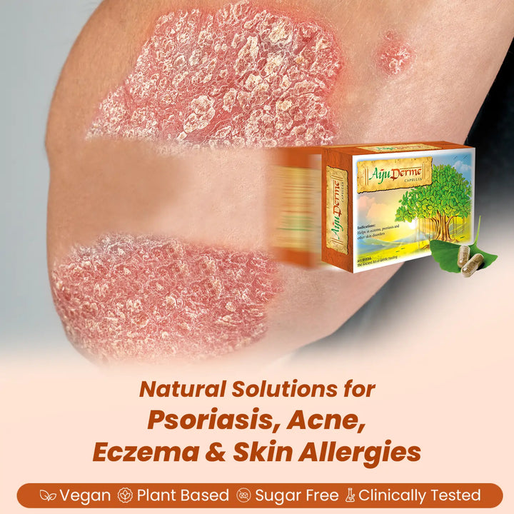 AyuDerme: A Natural Solution for Skin Disorders - Welex Care