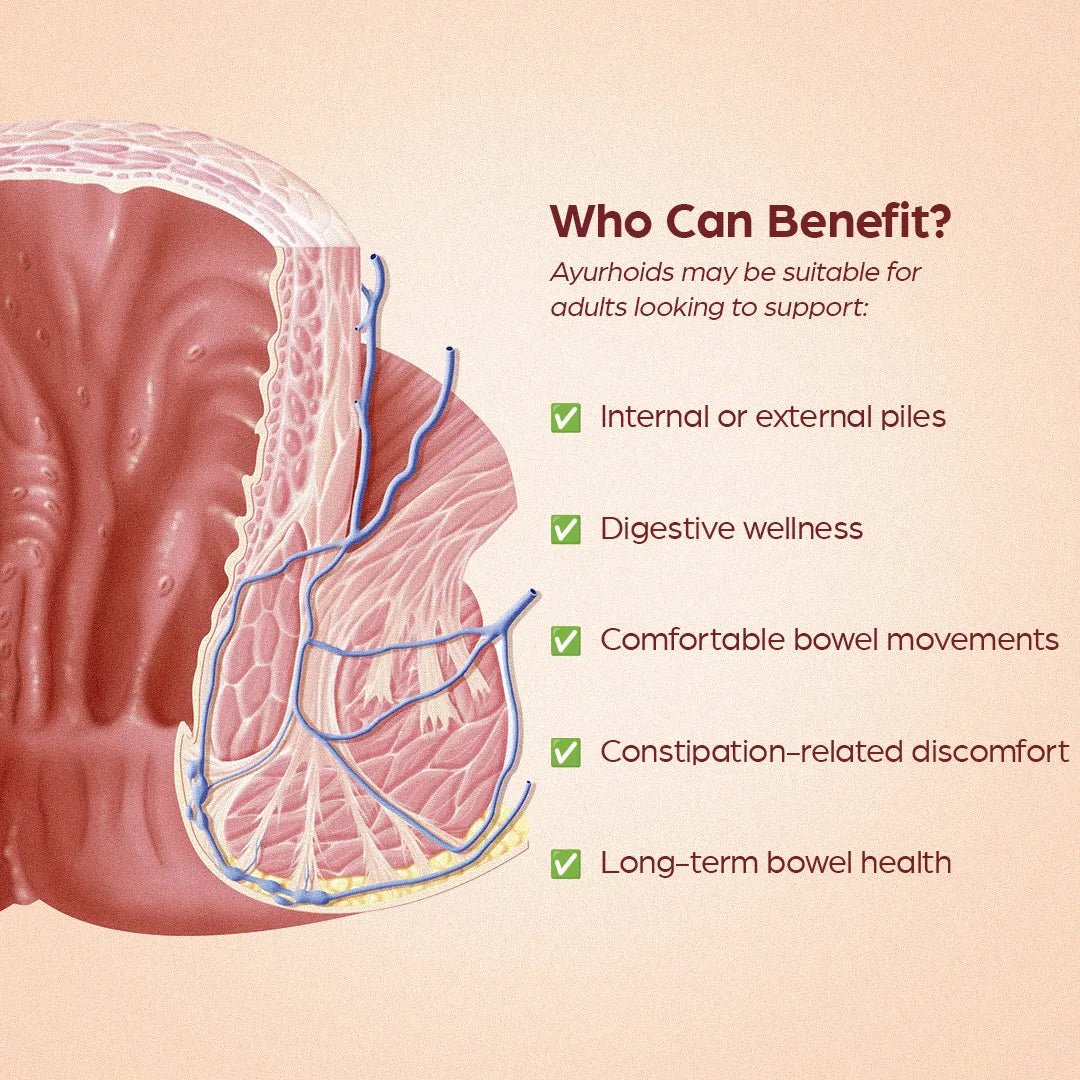 Ayurhoids: Ayurvedic medicine for piles/Hemorrhoids - Welex Care